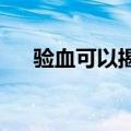 验血可以揭示类风湿性关节炎何时发作